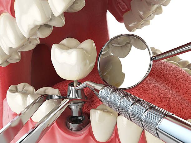 Best Cosmetic Emergency Dentistry in Jerseyvle, IL